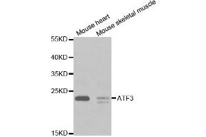 Western Blotting (WB) image for anti-Activating Transcription Factor 3 (ATF3) antibody (ABIN1871129) (ATF3 Antikörper)
