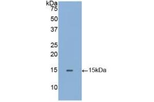 Western blot analysis of recombinant Human GLa. (GLA Antikörper  (AA 1-80))