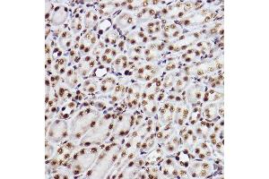Immunohistochemistry of paraffin-embedded mouse kidney using GTF2F2 Rabbit mAb (ABIN7267373) at dilution of 1:100 (40x lens). (GTF2F2 Antikörper)