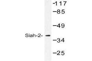 Western blot (WB) analysis of Siah-2 antibody in extracts from COLO cells. (SIAH2 Antikörper)