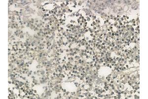 ABIN6257578 and ABIN6273604 at 1/100 staining human pituitary adenoma by IHC-P. (ZNF71 Antikörper  (N-Term))