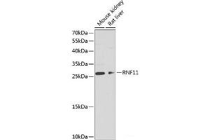 Western blot analysis of extracts of various cell lines using RNF11 Polyclonal Antibody at dilution of 1:1000.