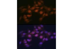 Immunofluorescence analysis of NIH-3T3 cells using WAPL Rabbit mAb (ABIN7271380) at dilution of 1:100 (40x lens). (WAPAL Antikörper)