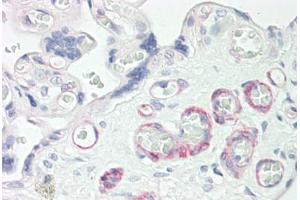 Anti-ZNF322A antibody IHC staining of human placenta.