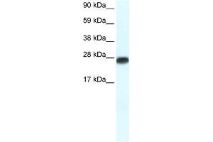 WB Suggested Anti-MYF6 Antibody Titration:  0. (MYF6 Antikörper  (N-Term))
