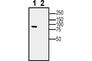 Western blot analysis of human  MG glioblastoma cell line lysate (lane 1) and  MG-derived purified exosomes (lane 2)50μg of cells and purified exosomes lysates were analyzed using Anti-Calnexin Antibody (ABIN7043021, ABIN7044212 and ABIN7044213), (1:600). (Calnexin (CANX) Peptid)
