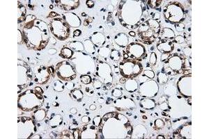 Immunohistochemical staining of paraffin-embedded Kidney tissue using anti-CD36mouse monoclonal antibody. (CD36 Antikörper)
