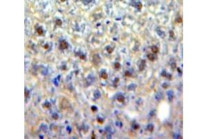 Used in DAB staining on fromalin fixed paraffin-embedded Liver tissue (EGR4 Antikörper  (AA 231-474))