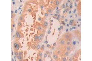 IHC-P analysis of Kidney tissue, with DAB staining. (HRAS Antikörper  (AA 82-176))