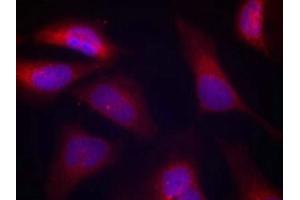 Immunofluorescence staining of methanol-fixed Hela cells using PKR(Phospho-Thr446) Antibody. (EIF2AK2 Antikörper  (pThr446))