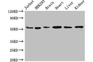 Western Blot Positive WB detected in: Jurkat whole cell lysate, HEK293 whole cell lysate, Mouse brain tissue, Mouse heart tissue, Mouse liver tissue, Mouse kidney tissue All lanes: SLC18A2 antibody at 3. (SLC18A2 Antikörper  (AA 463-514))