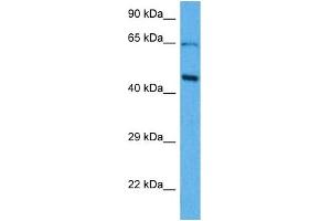 Host:  Mouse  Target Name:  SOX18  Sample Tissue:  Mouse Brain  Antibody Dilution:  1ug/ml (SOX18 Antikörper  (Middle Region))