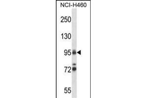 TOP1 Antibody (N-term) (ABIN657818 and ABIN2846785) western blot analysis in NCI- cell line lysates (35 μg/lane). (Topoisomerase I Antikörper  (N-Term))
