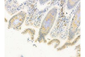 anti-General Transcription Factor IIIC, Polypeptide 4 (GTF3C4) (Internal Region) antibody
