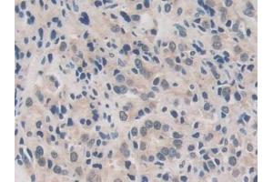 Immunohistochemistry (IHC) image for anti-Ubiquitin Specific Peptidase 7 (Herpes Virus-Associated) (USP7) (AA 54-507) antibody (ABIN7443551)