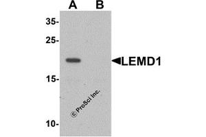 Western Blotting (WB) image for anti-LEM Domain Containing 1 (LEMD1) (Middle Region) antibody (ABIN1030979) (LEMD1 Antikörper  (Middle Region))