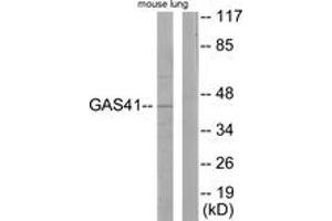 Western Blotting (WB) image for anti-YEATS Domain Containing 4 (AA 1-50) antibody (ABIN2889365) (GAS41 Antikörper  (AA 1-50))