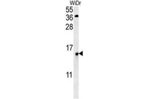 C19orf50 Antibody (C19orf50 Antikörper  (Middle Region))