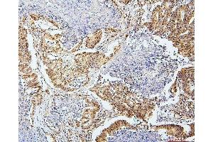 IHC analysis of SAE2/UBA2 using anti-SAE2/UBA2 antibody (ABIN7601755).