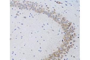Immunohistochemistry of paraffin-embedded Rat brain using TNFSF12 Polyclonal Antibody at dilution of 1:100 (20x lens). (TWEAK Antikörper)