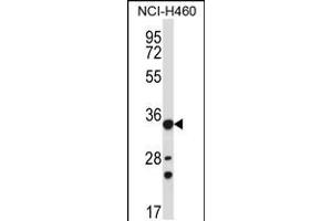 Western blot analysis in NCI-H460 cell line lysates (35ug/lane). (AKR1B10 Antikörper  (AA 101-130))