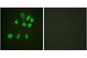 Immunofluorescence analysis of HeLa cells, using Estrogen Receptor-beta (Ab-105) Antibody. (ESR2 Antikörper  (AA 71-120))