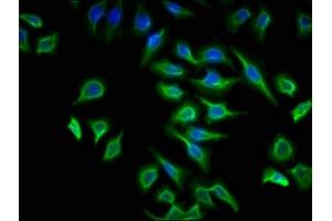 Immunofluorescence (IF) image for anti-ATPase, H+ Transporting, Lysosomal 13kDa, V1 Subunit G2 (ATP6V1G2) (AA 1-118) antibody (ABIN7175266)