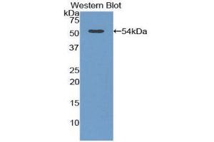 Western Blotting (WB) image for anti-Adiponectin Receptor 2 (ADIPOR2) (AA 180-367) antibody (ABIN1857920)