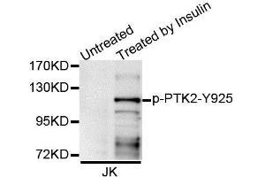 Western blot analysis of extracts of Jurkat cell line, using Phospho-PTK2-Y925 antibody (ABIN5995626). (FAK Antikörper  (pTyr925))