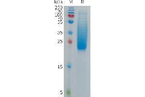 Cynomolgus IL18BP Protein, His Tag on SDS-PAGE under reducing condition.