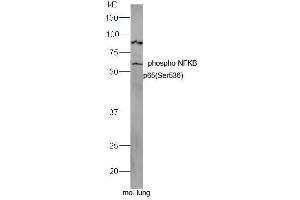 Mouse lung lysates probed with Rabbit Anti-NFkB p65 (Ser536) Polyclonal Antibody, Unconjugated  at 1:5000 for 90 min at 37˚C. (NF-kB p65 Antikörper  (pSer536))