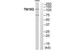 Western blot analysis of extracts from LOVO cells, using TM16G antiobdy. (Anoctamin 7 Antikörper  (C-Term))