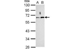 WB Image Sample (30 ug of whole cell lysate) A: Jurkat B: K562 10% SDS PAGE antibody diluted at 1:1000 (RAD9A Antikörper  (Center))