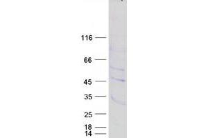 Western Blotting (WB) image for Prostate Tumor Overexpressed 1 (PTOV1) protein (Myc-DYKDDDDK Tag) (ABIN2730093)
