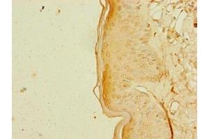 Immunohistochemistry of paraffin-embedded human skin tissue using ABIN7168349 at dilution of 1:100 (RBM41 Antikörper  (AA 1-413))