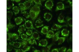 Immunostaining of HeLa cells with the anti-mitochondria antibody. (Mitochondria Antikörper)