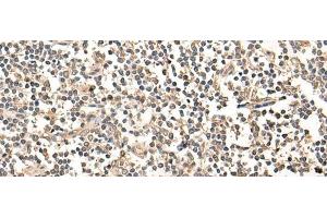 Immunohistochemistry of paraffin-embedded Human tonsil tissue using MAGEA1 Polyclonal Antibody at dilution of 1:65(x200) (MAGEA1 Antikörper)