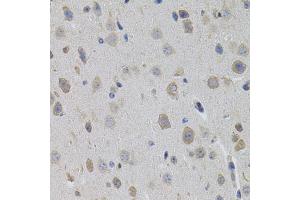Immunohistochemistry of paraffin-embedded mouse brain using SUMO3 antibody (ABIN5971585) (40x lens). (SUMO3 Antikörper)
