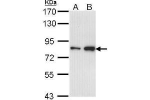 WB Image Sample (30 ug of whole cell lysate) A: A431 , B: H1299 7. (CTDP1 Antikörper  (N-Term))
