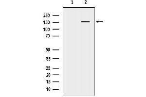 Western blot analysis of lysates from Rat brain, using SMC4 Antibody.