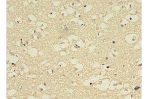 Immunohistochemistry of paraffin-embedded human brain tissue using ABIN7149247 at dilution of 1:100 (CYP2E1 Antikörper  (AA 49-288))