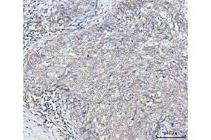IHC analysis of Golgin 97/GOLGA1 using anti-Golgin 97/GOLGA1 antibody (ABIN7599539). (GOLGA1 Antikörper  (AA 1-752))