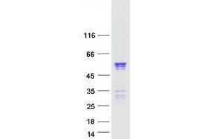 Validation with Western Blot