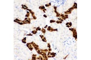 IHC-P: Calbindin antibody testing of mouse kidney tissue