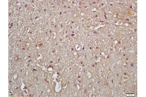 Formalin-fixed and paraffin embedded rat brain labeled with Rabbit Anti-IKK gamma (Ser376) Polyclonal Antibody, Unconjugated  at 1:200 followed by conjugation to the secondary antibody and DAB staining (IKBKG Antikörper  (pSer376))