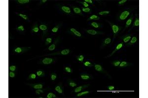 Immunofluorescence of purified MaxPab antibody to EWSR1 on HeLa cell. (EWSR1 Antikörper  (AA 1-656))