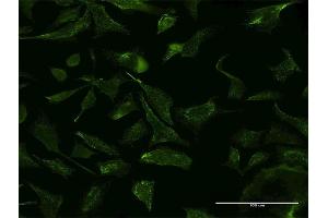 Immunofluorescence of monoclonal antibody to VCP on HeLa cell. (VCP Antikörper  (AA 1-110))