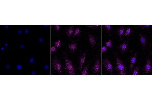 Immunocytochemical staining of H9C2 cells with Period circadian regulator 3 antibody (ABIN7799773), 1:1,000). (Rekombinanter PER3 Antikörper)