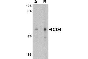 Western Blotting (WB) image for anti-CD4 (CD4) (N-Term) antibody (ABIN492543) (CD4 Antikörper  (N-Term))