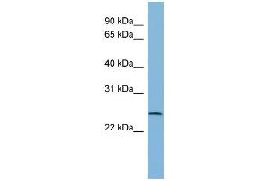 WB Suggested Anti-CXorf26 Antibody Titration: 0. (CXorf26 Antikörper  (Middle Region))